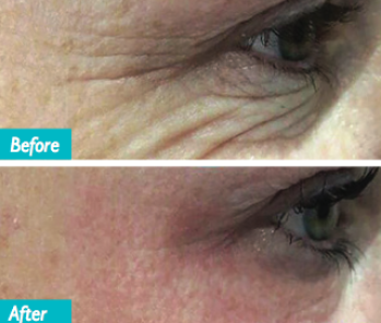 Do you dream of tighter, fresher, more youthful skin?